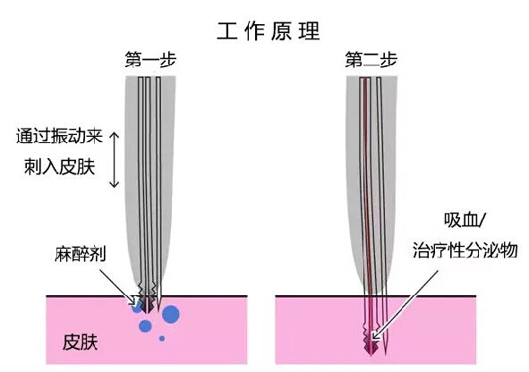 为了生态，荷兰人很会有效利用昆虫资源